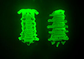 SPINES